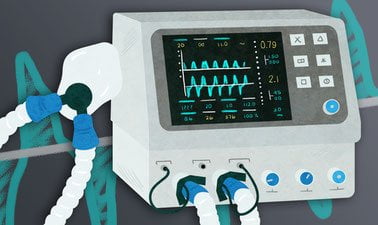 Stiati ca...in COVID-19 ventilatia mecanica se face astfel?!