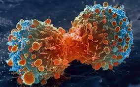 Rolul nutritiei in terapia bolii canceroase. Inhibitori de glicoliza, substante redox-active si inductori de apoptoza, practic lipsiti de efecte secundare.   Bazele moleculare ale constructiei regimului alimentar ortomolecular în cancer.