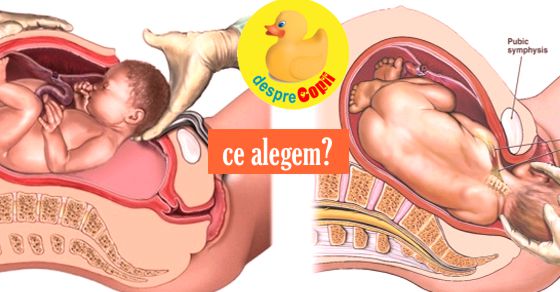 Stiati ca ... femeile nascute prin cezariana pot fi predispuse la obezitate si diabet?!